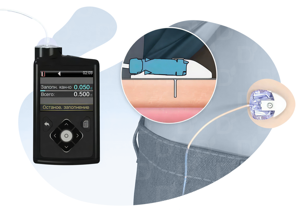 БЛОГ-0001.png БЛОГ-0001.png