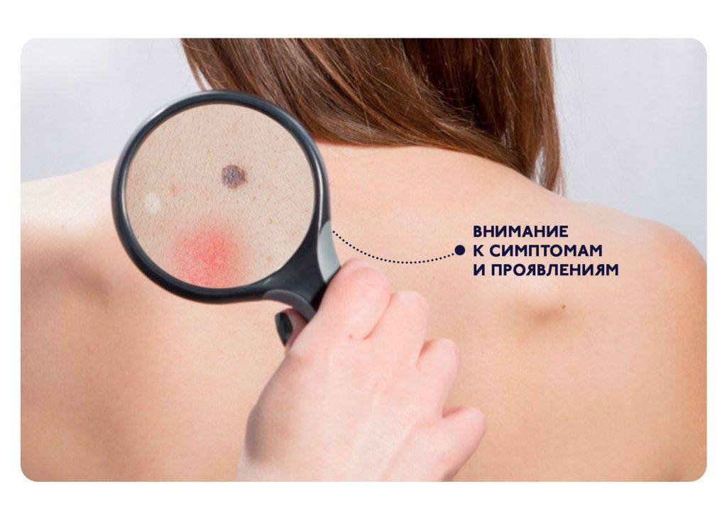 БЛОГ-2.jpg БЛОГ-2.jpg