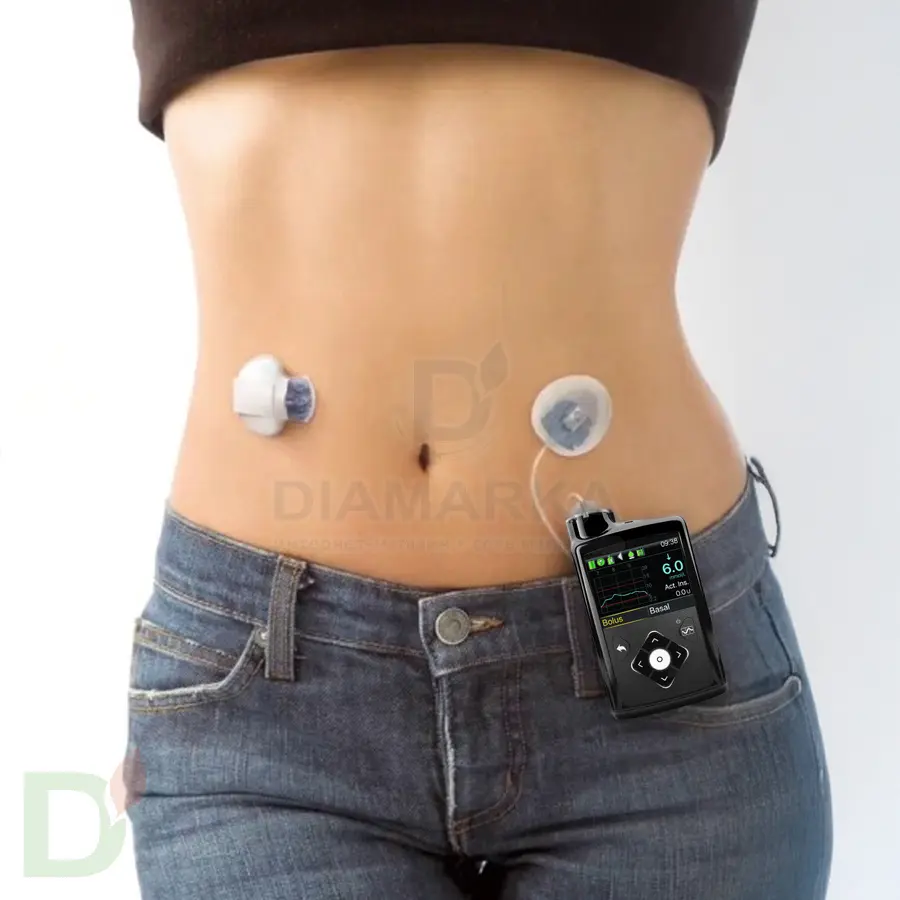 Инсулиновая помпа Medtronic MiniMed 780G с болюсами автокоррекции, MMT-1895