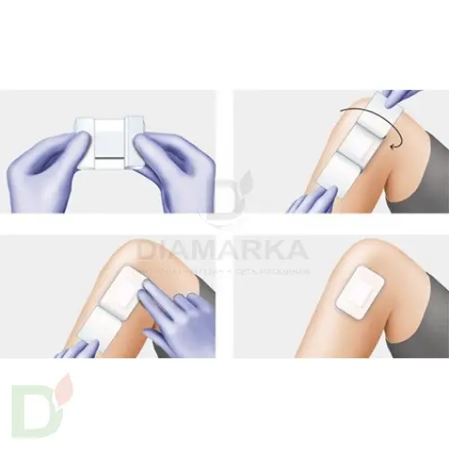 Пластырь COSMOPOR E на нетканой основе 7,2 х 5см №1